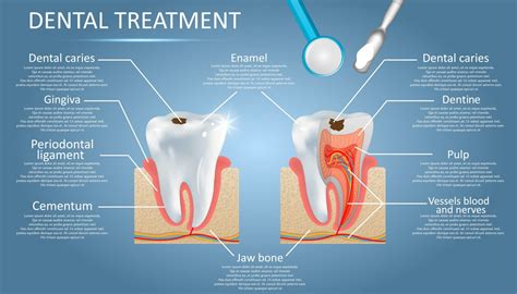 When it comes to your dental .